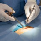 Varun Group - Treatment & Procedures